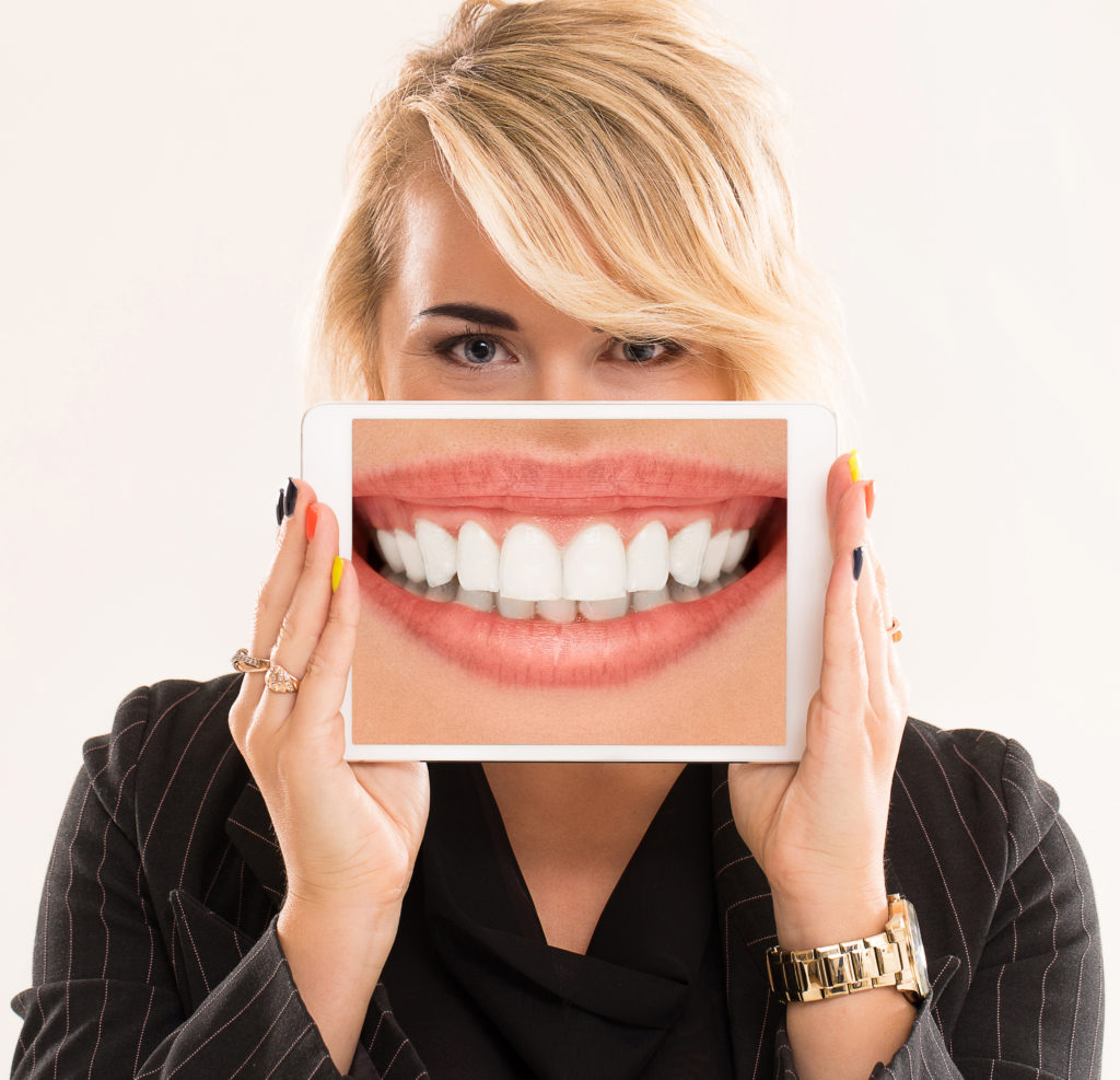 Dobre wybielanie zębów to jednolita biel na całej ich powierzchni.
